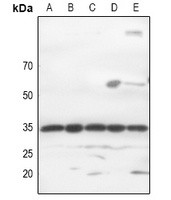 GTF2E2 antibody Catalog Number: orb214024