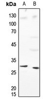 HIST1H1B antibody Catalog Number: orb214030